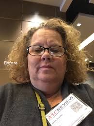 Weight loss with zepbound program