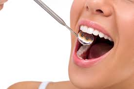「lingual orthodontics」の画像検索結果