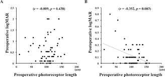 447 likes · 8 talking about this. Correlation Between Preoperative Factors And Final Visual Acuity After Successful Rhegmatogenous Retinal Reattachment Scientific Reports