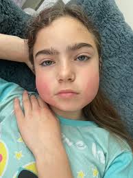 What are safe and natural lotions for dry and itchy skin?