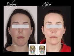 Clínica Dental Campoy & Alvarez-Gómez