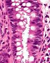 Image result for cryptosporidium