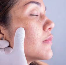 World Skin Health Day 2020 making teledermatology more accessible