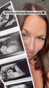 Pregnancy after loss is tough. Really tough. Some days it feels almost  impossible to navigate but so many of us are trying that there are some  things we need to normalise… It's