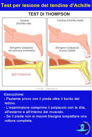 Quali sono le cause delle lesioni del tendine d'achille? Rottura Del Tendine D Achille I Sintomi E La Riabilitazione