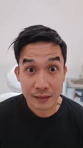 Romeo Manuel "Ram" E. Bernal III, MD RB Elixir Embellir Medical Group,  Founder & Medical Director Dr. Ram is a duly certified Aesthetic skin  expert, having completed a degree in BS Human