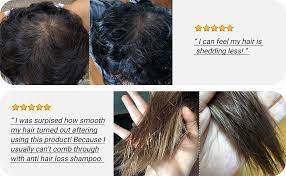 It actually adds a nice texture. Amazon Com Crazy Skin Beers Shampoo 300g Ph 5 5 German Beer Yeast Scalp Care Hair Shampoo Shampoo For Thinning Hair And Hair Loss Rich In Biotin Protein Contained Paraben Free Beauty