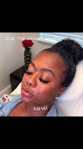 Customizable 6 ML GrayBae Contour Package in Baltimore