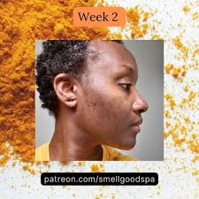 Official Smell Good Spa: Mature Skin Hyperpigmentation Skin Care|  Niacinamide Skin Care