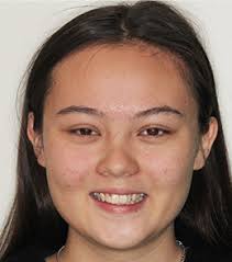 Book Your Orthodontic Consultation