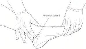 Posterior Tibial Artery Lies Just Posterior To The Medial Malleolus It Can Be Felt Most Readily By Curling The Fin Nursing Notes Nurse Life Nursing Care Plan