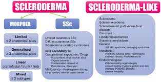 Image result for Systemic Sclerosis