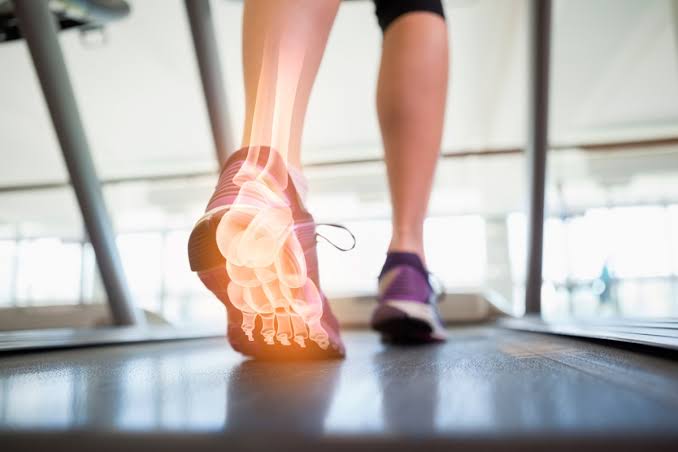 Dolor de Pie al Correr: Alívialo y Evita que Vuelva