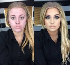 unbelivable before and after shots