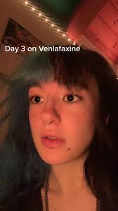 Phanxy 3 in 1 Review: Day 3