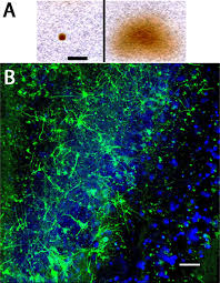 Die begriffe nanopartikel bzw.nanoteilchen bezeichnen verbünde von einigen wenigen bis einigen tausend atomen oder molekülen.der name nano bezieht sich auf ihre größe, die typischerweise bei 1 bis 100 nanometern liegt; Regioselective Biolistic Targeting In Organotypic Brain Slices Using A Modified Gene Gun Protocol Translated To German