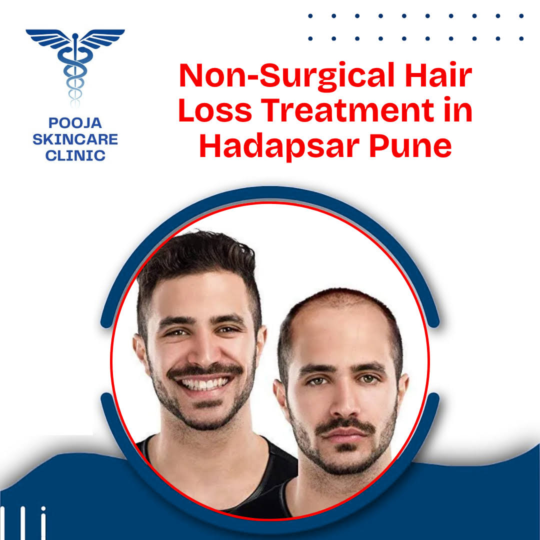 Non-Surgical Hair Loss Treatment in Hadapsar Pune product image