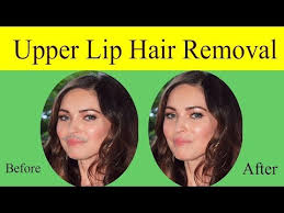 In this video, i have shared 4 permanent ways to remove unwanted hair,facial hair,underarm hair removal,lip hair removal,flip hair,leg hair removal,armpit hair removal,arm hair removal and back hair removal fast and completely at home without irritating the skin. Upper Lip Hair Removal At Home Naturally Remove Permanently Hair Form Upper Lips Just 2 Items Baji Parveen