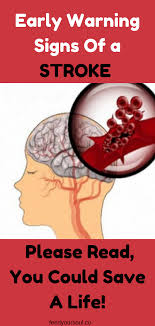 Account Suspended Stroke Symptoms Warning Signs How To Stay Healthy