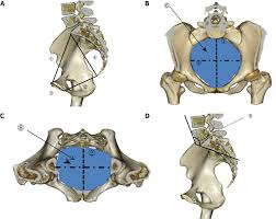 Image result for Pelvimetry