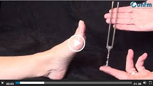 Image result for Tuning Fork Test