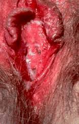 Resultado de imagen de piercings en la vulva