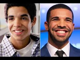 Drake hasn't forgotten where he came from. Can Drake And Jimmy Brooks Both Exist In The Degrassi Universe Youtube