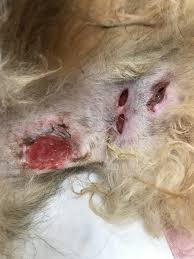 Image result for Panniculitis