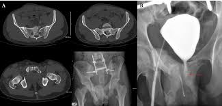Image result for Genitourinary Trauma