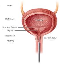 Image result for Stress Incontinence