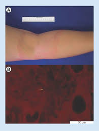 Image result for Pseudoeriosema borianii