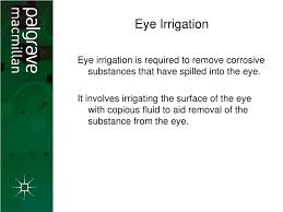 Image result for Eye Irrigation