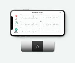 Alivecors Fda Cleared 6 Lead Ecg Aims To Detect More Than