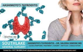Image result for Thyroiditis
