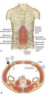 Anatomy of the palm of the hand dr. Cirbosque Some4surgery On Twitter The Palmer Point For Safe Port Laparoscopic Entry In Adhesive Small Bowel Obstruction Some4surgery Medtwitter Swexner Juliomayol Topknife B Docmartin22 Misirg1 Almagoch Pferrada1 Elliotthaut Pipecabrerav