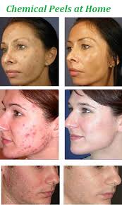 Pin On Skincare