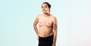 Breast Reduction Surgery: Cost Uk, Nhs, Before And After, Scars.