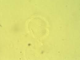 Image result for Maytenus undata