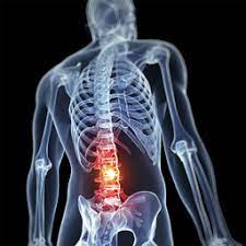 Signs of a breast infection, including local redness, pus, or fever. Cancer Patients When To Worry About Back Pain City Of Hope Breakthroughs