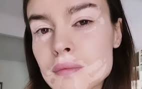 Born 13 august 1979) is a polish actress smutniak was born in piła, poland. Kasia Smutniak Dopo La Vitiligine Cosi Inventa Il Filtro Della Diversita Il Tempo