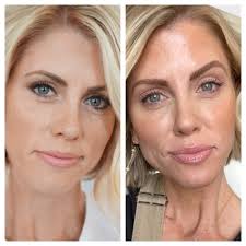 Skincare Regimen Guide