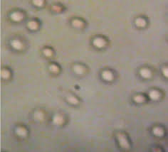 Image result for Thomandersia hensii