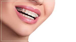 For more about do damaged gums grow back? How To Know If You Need Braces