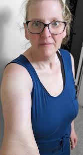 Comfortable Aldi dress after gall bladder surgery