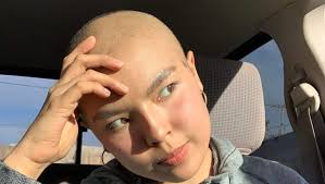 Fundraiser for Judith Santellana by Marcos Vasquez : Cancer Radiation  Therapy 18 Years Old