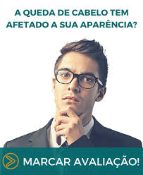 Implante Capilar de outra pessoa: posso usar? Dr. Armando Cunha