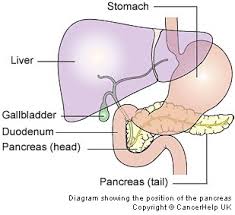 We explain pancreas, gallbladder, & liver with video tutorials and quizzes, using our many ways(tm) approach from multiple teachers. The Pancreatic And Biliary Stent