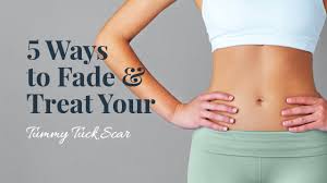 Many plastic surgeons offer patient financing plans for panniculectomy surgery in instances where health insurance does not cover it, so be sure to ask. 5 Ways To Fade Treat Your Tummy Tuck Scar Edina Plastic Surgery