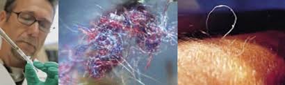 Unexpected psychodermatological problem for parasitologists впервые термин morgellons disease появился в 2002 г. Morgellons