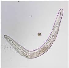 Check spelling or type a new query. A New Worm Infiltrating The Human Cornea A Report Of Three Cases Sciencedirect
